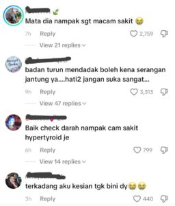 “Turun mendadak pun boleh kena serangan jantung ya” Mata Tersembul Bikin Netizen Cemas, Pakar Bariatrik Dedah Keadaan Terkini Fatin
